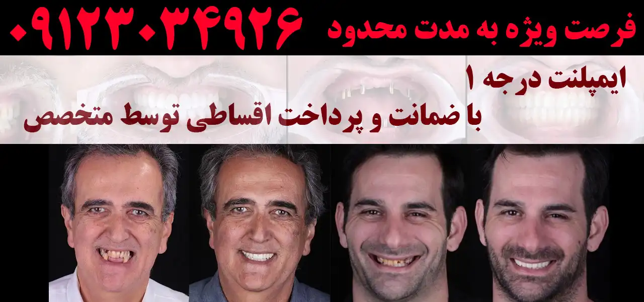 دندانپزشکی-آمتیس(2)