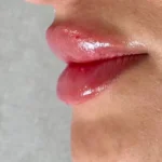 کلینیک زیبایی دلا در مطهری