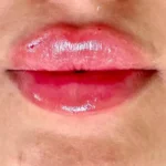 کلینیک زیبایی دلا در مطهری