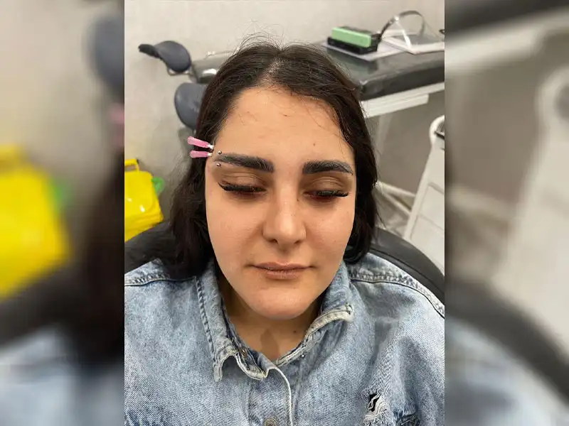 کلینیک زیبایی دلا در مطهری