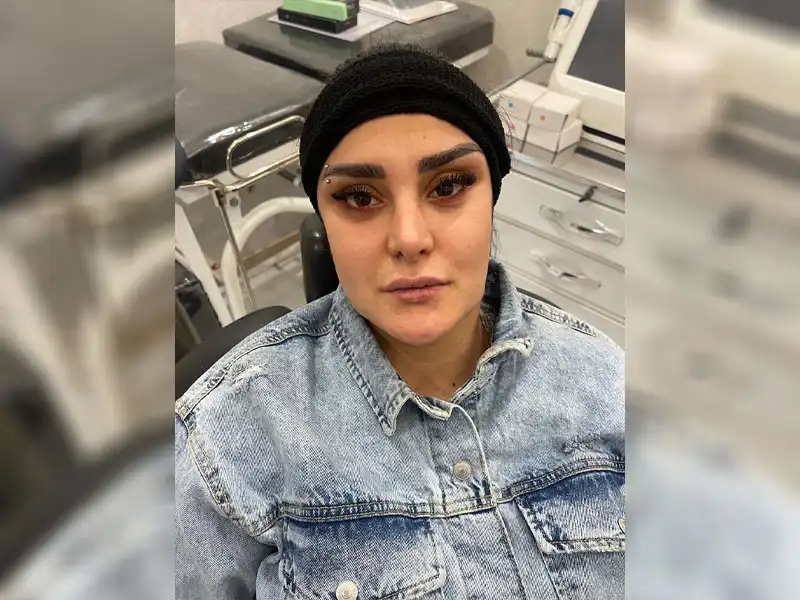 کلینیک زیبایی دلا در مطهری