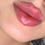 کلینیک زیبایی دلا در مطهری