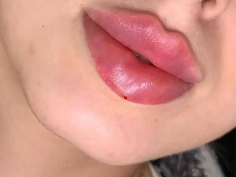 کلینیک زیبایی دلا در مطهری