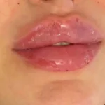 کلینیک زیبایی دلا در مطهری