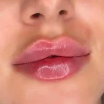 کلینیک زیبایی دلا در مطهری