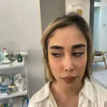 کلینیک زیبایی دلا در مطهری