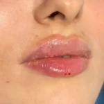 کلینیک زیبایی دلا در مطهری