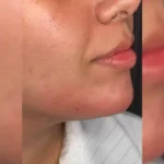 کلینیک زیبایی دلا در مطهری