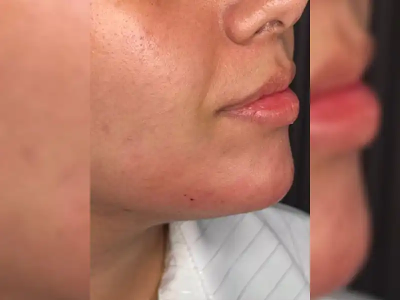 کلینیک زیبایی دلا در مطهری