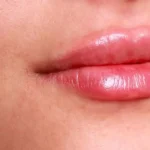 کلینیک زیبایی دلا در مطهری