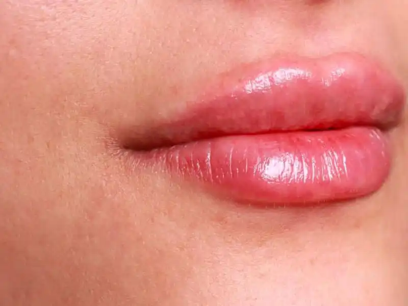 کلینیک زیبایی دلا در مطهری