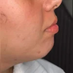 کلینیک زیبایی دلا در مطهری