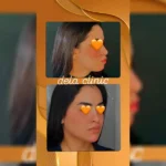 کلینیک زیبایی دلا در مطهری