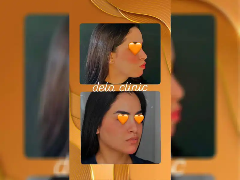 کلینیک زیبایی دلا در مطهری