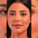 کلینیک زیبایی دلا در مطهری