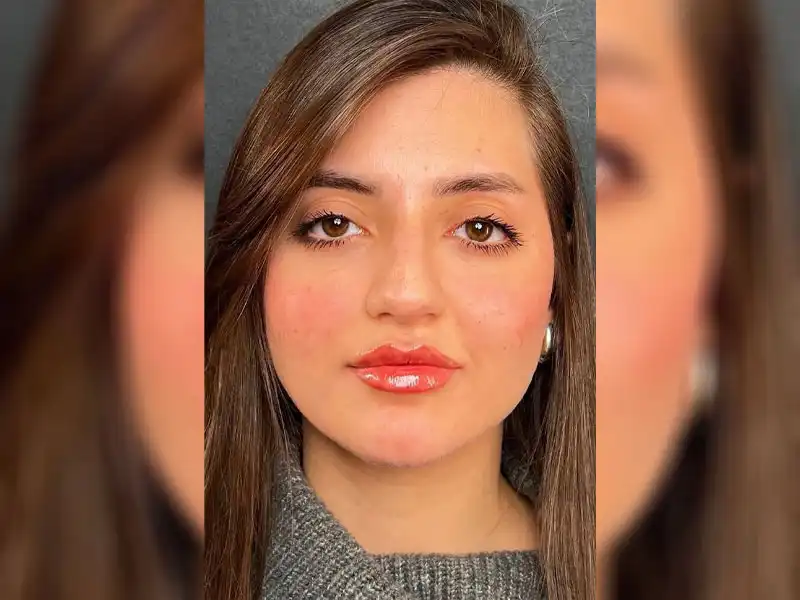 کلینیک زیبایی دلا در مطهری