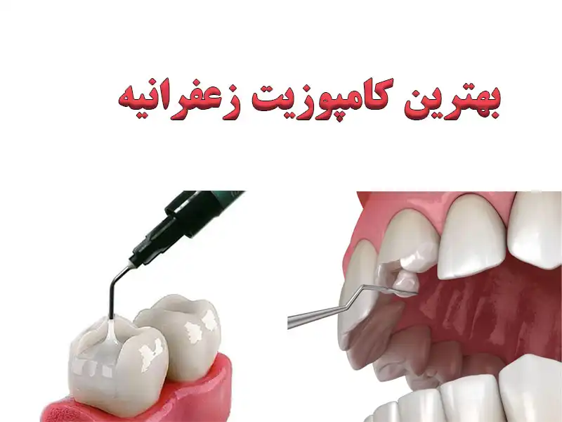 بهترین-کامپوزیت-زعفرانیه