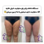 باشگاه ورزشی سون فیت پاور تخصصی ای ام اس در اشرفی اصفهانی