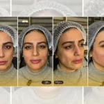 کلینیک زیبایی گندم زار در یافت آباد