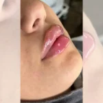 کلینیک زیبایی گندم زار در یافت آباد