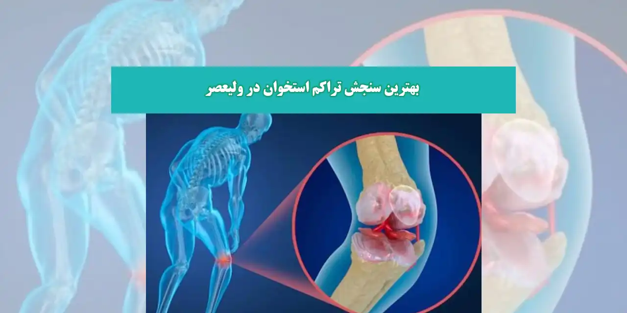 تراکم-استخوان-شاخص