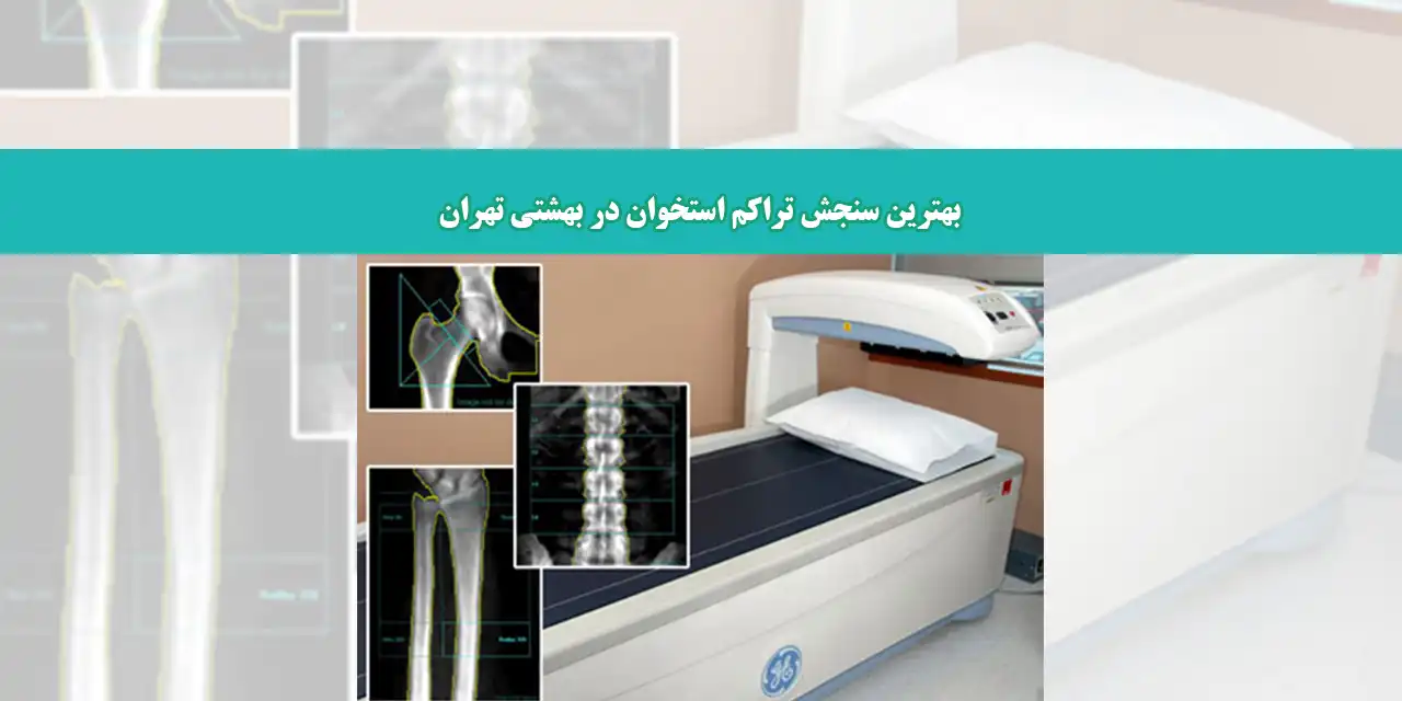 تراکم-بهشتی