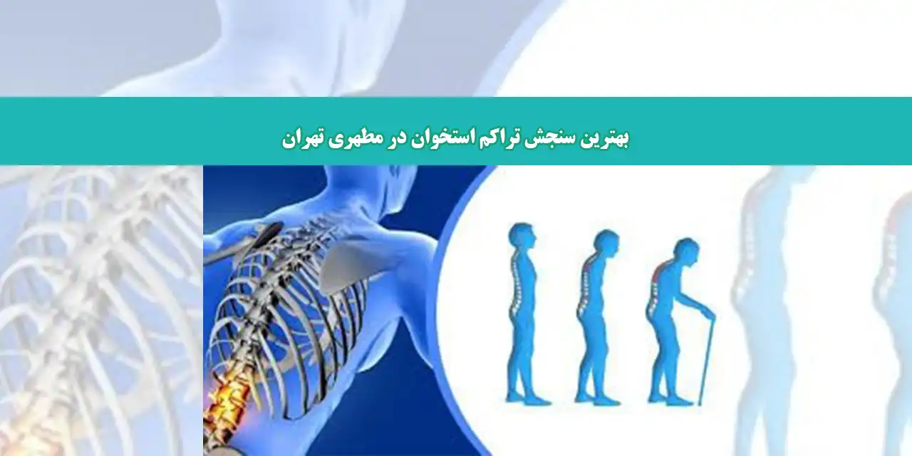 تراکم-مطهری