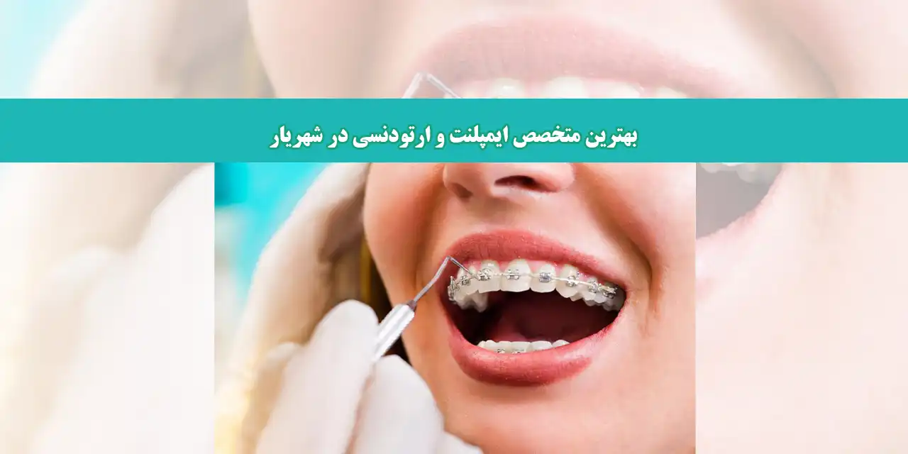 شاخص-ایمپلنت