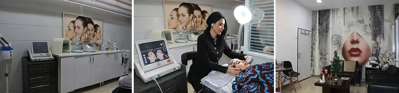 بلاگ-موژا