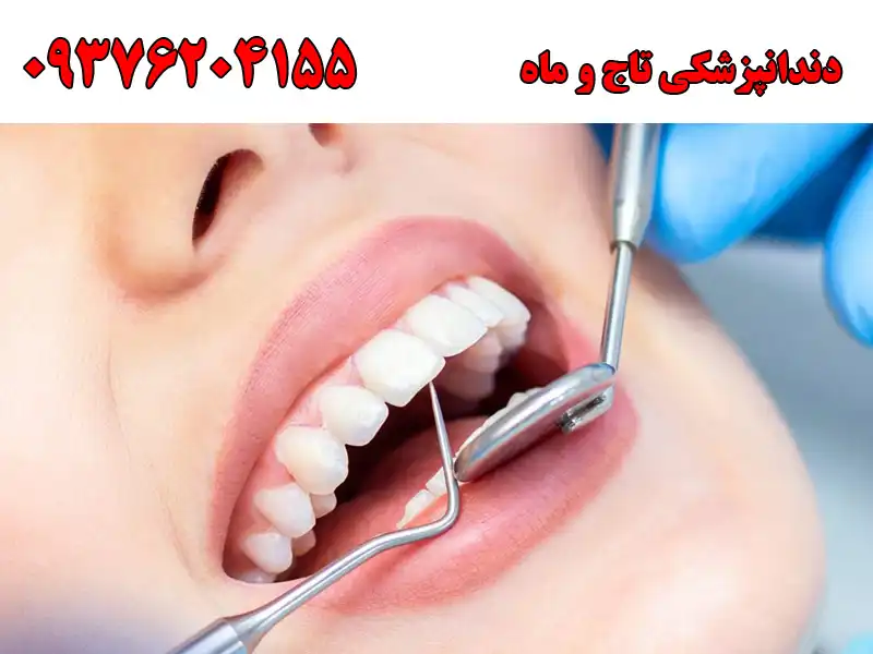 دندانپزشکی تاج و ماه در صادقیه