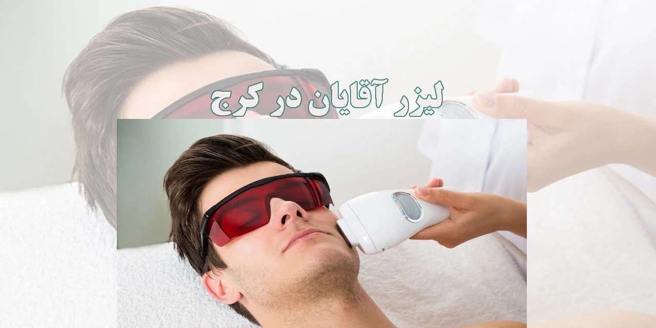 لیزر-آقایان-در-کرج