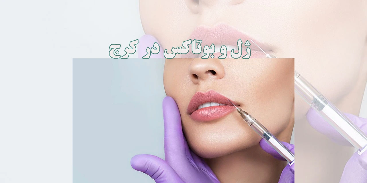 ژل-و-بوتاکس-در-کرج