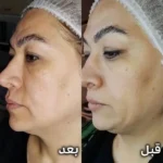 کلینیک زیبایی بیوتی طب در طالقانی کرج