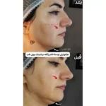 کلینیک زیبایی بیوتی طب در طالقانی کرج