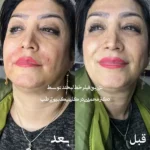 کلینیک زیبایی بیوتی طب در طالقانی کرج