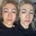 کلینیک زیبایی بیوتی طب در طالقانی کرج