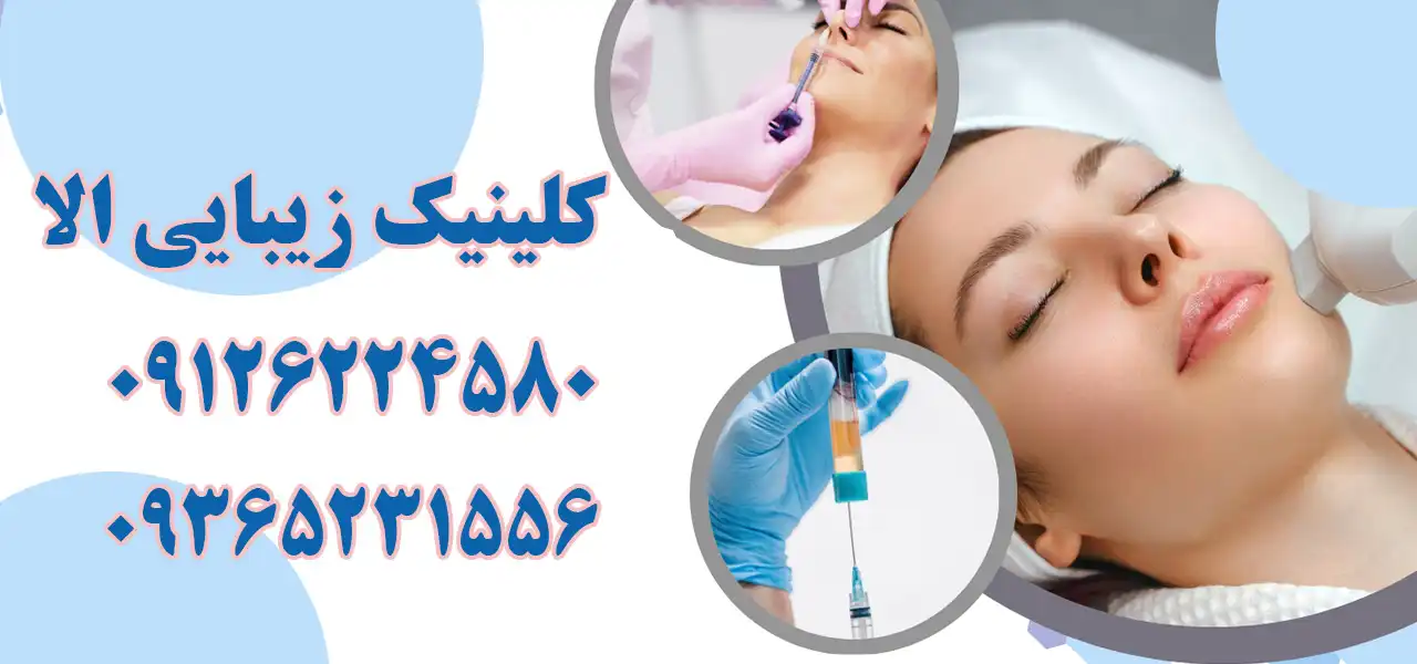 بنر-الا