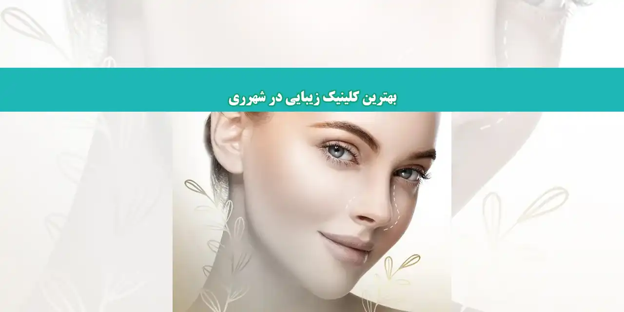 شاخص-زیبایی