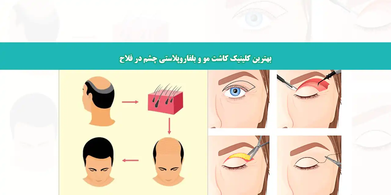 شاخص-کلینیک