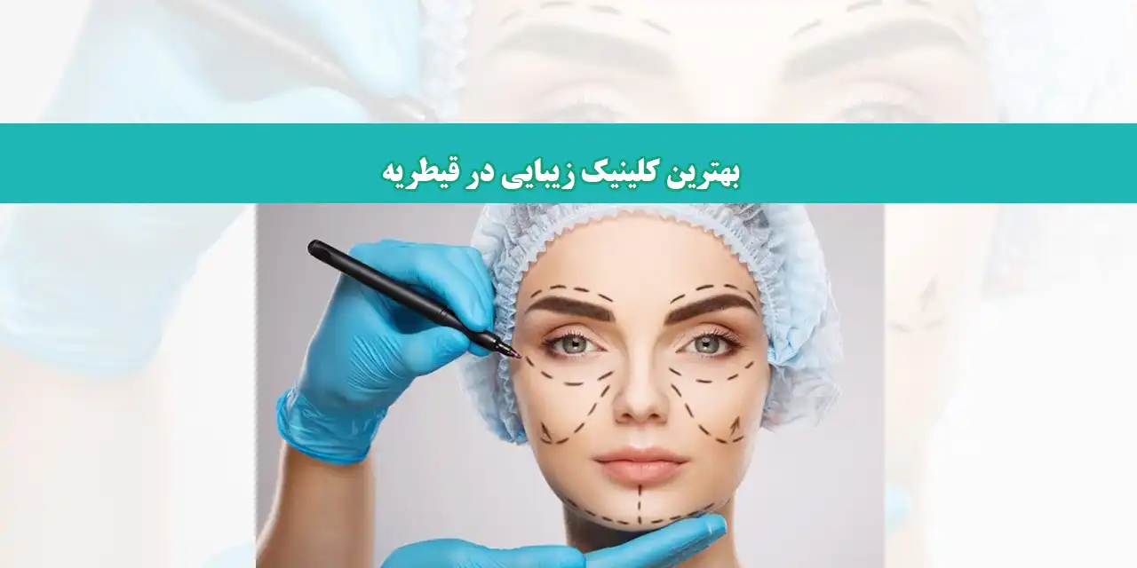 زیبایی-شاخص