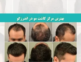 شاخ-کاشت