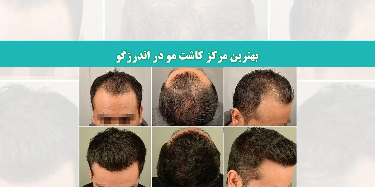 شاخ-کاشت