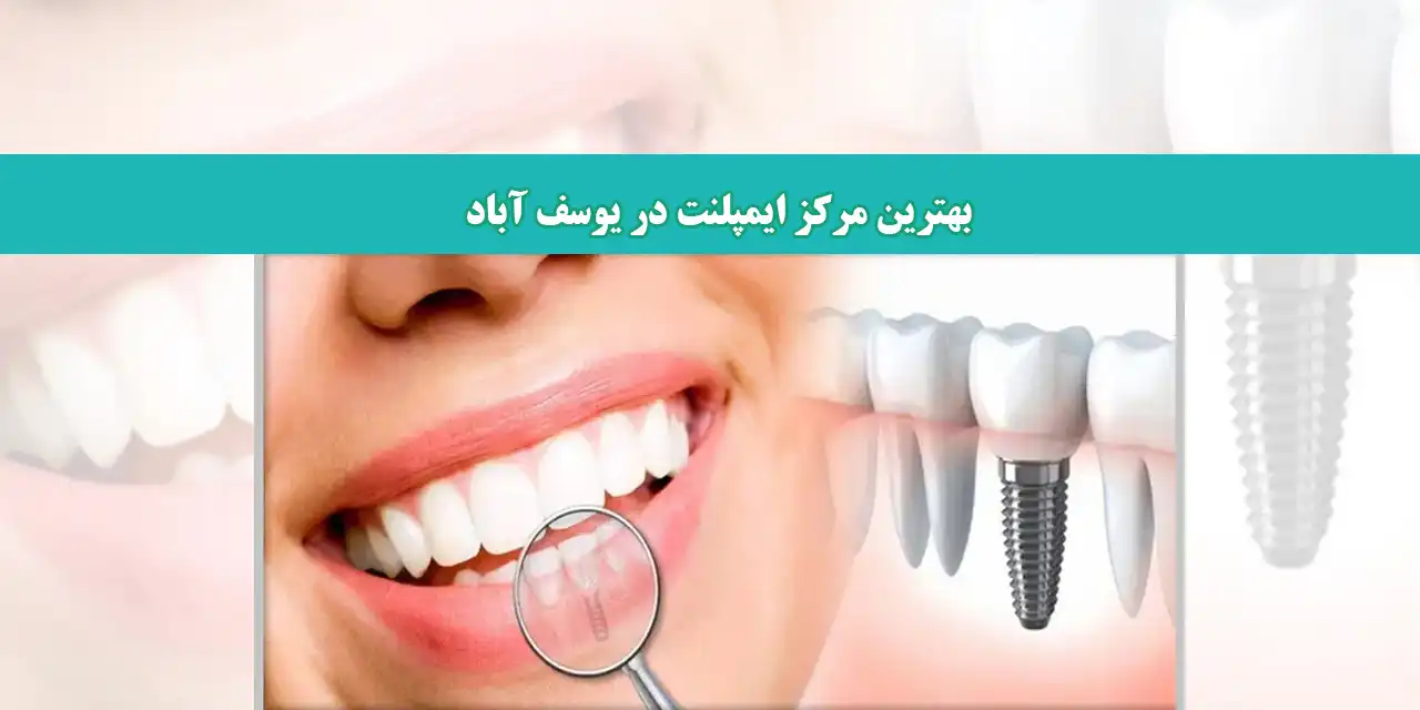 شاخص-ایمپلنت