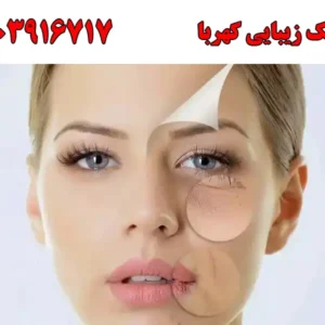 شاخص-پوست