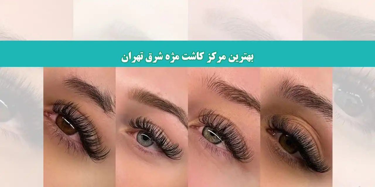 شاخص-کاشت-مژه