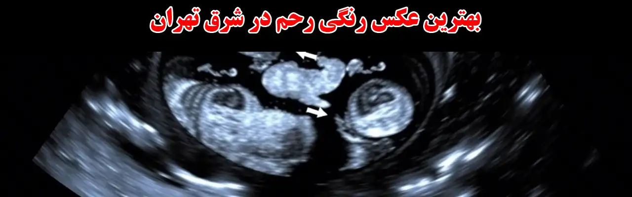 15-بهترین-عکس-رنگی-رحم-در-شرق-تهران