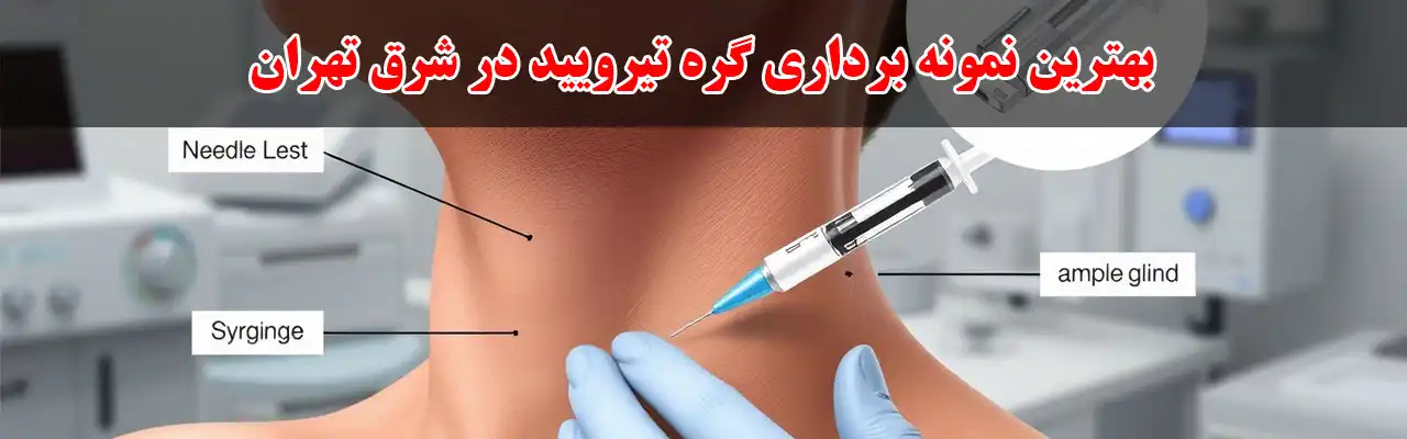 15-بهترین-نمونه-برداری-گره-تیرویید-در-شرق-تهران