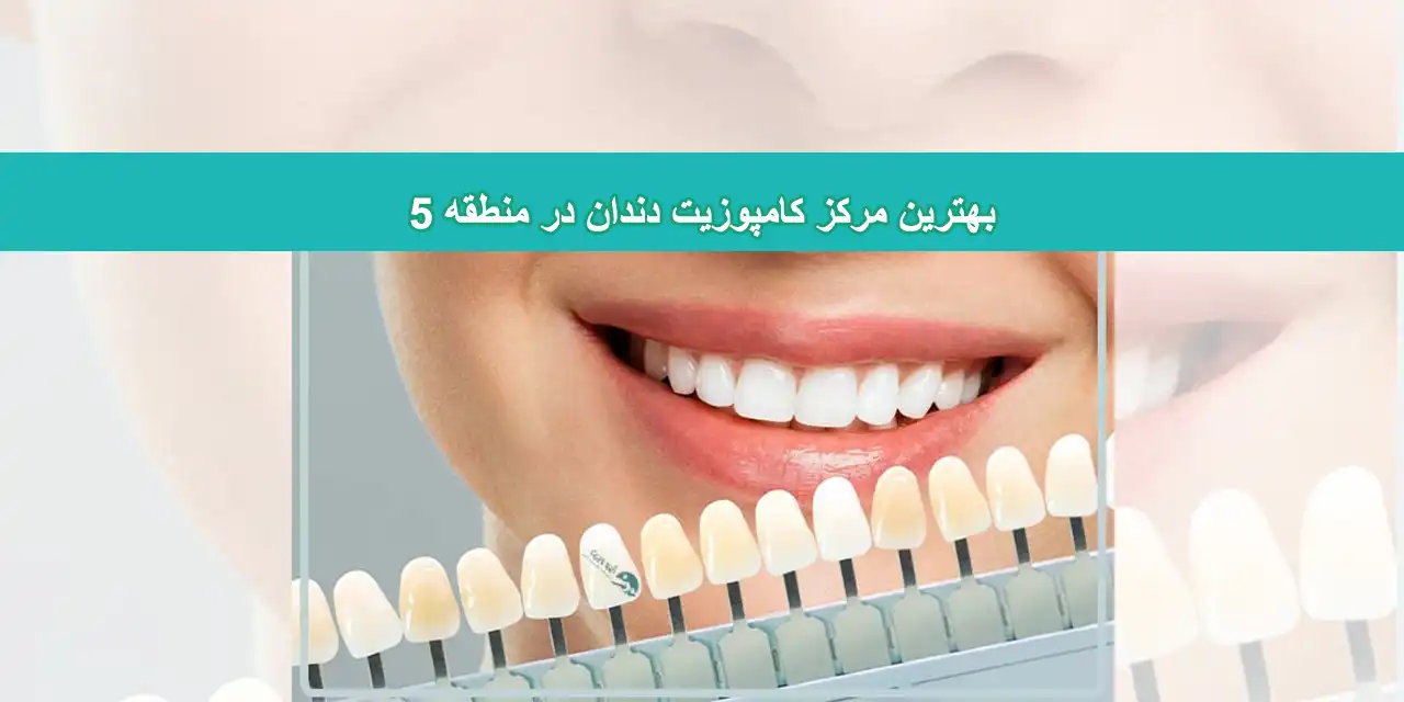 شاخص-کامپوزیت