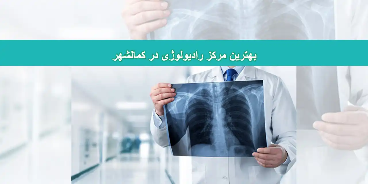 شاخص-کمتالشهر