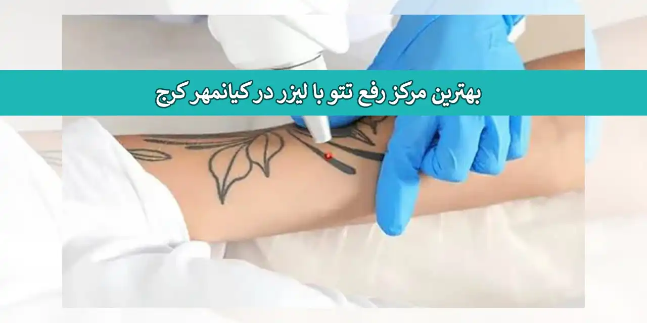 تاتو-کیانمهر